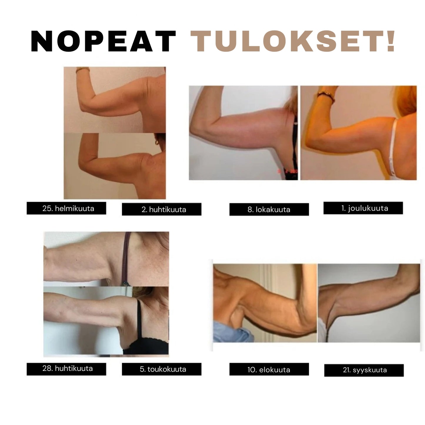 Cellumove 3D-muovattavat hihat – Ei enää allikäsivarsia